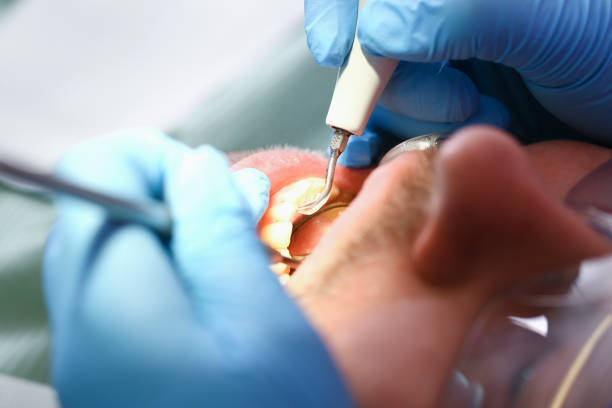 Best Emergency Broken Tooth Repair in El Campo, TX